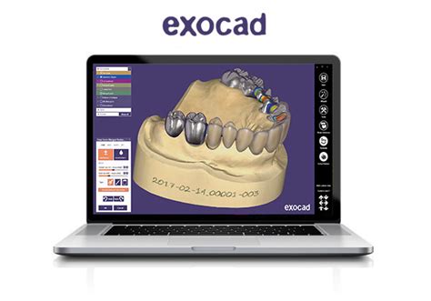 Exocad DentalCAD Rimas Engineering 3D Solutions