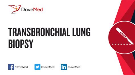 Transbronchial Lung Biopsy - DoveMed