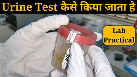 Urine Test Kaise Kiya Jata Hai Urine R M Routine And Microscopy Urine Test Procedure