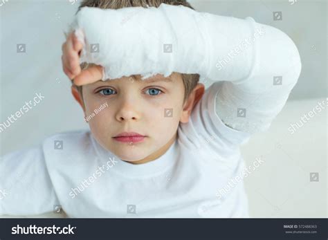 Child Broken Arm Stock Photo 572488363 Shutterstock