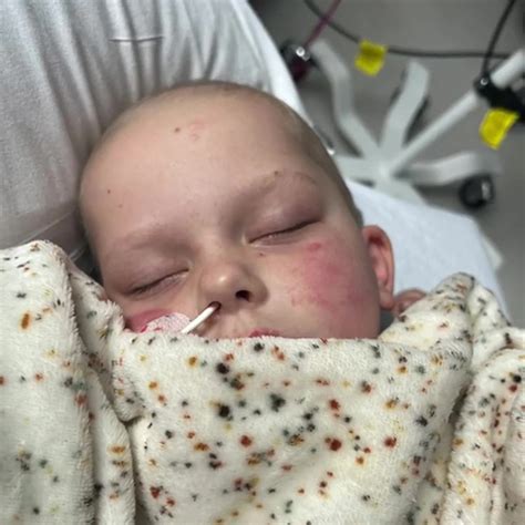 Mum heartbroken as toddler's constant fatigue and 'unexplained' bruises