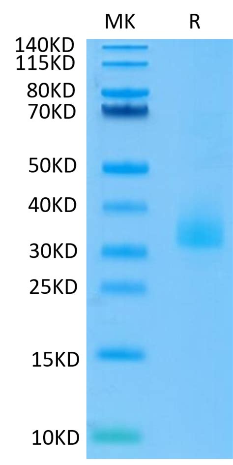 Recombinant Human Angiopoietin Like Protein C His Avi Hek Bio