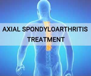 2018 APLAR Guidance for axial spondyloarthritis treatment