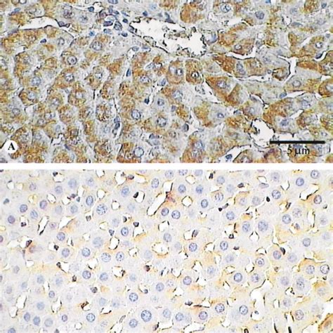 Immunohistochemical Analysis Of Nitrotyrosine In Liver Specimens Download Scientific Diagram