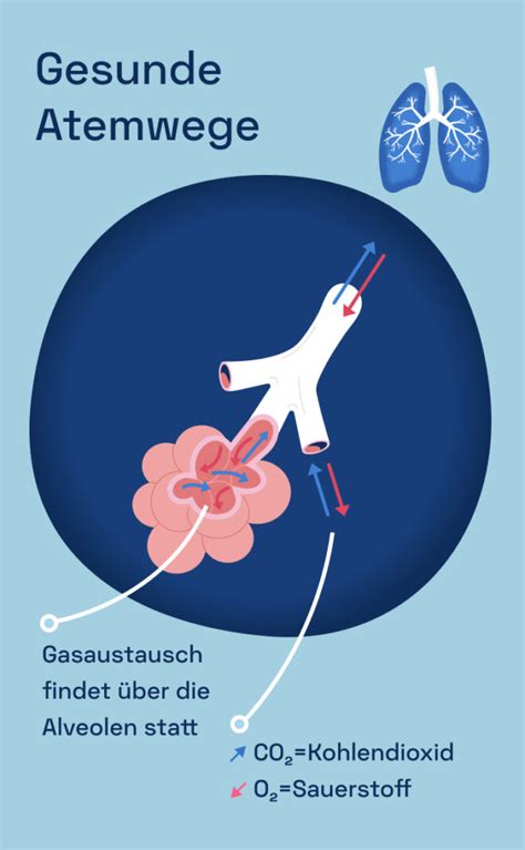 Copd Ursachen Behandlung Und Symptome Kaia Health