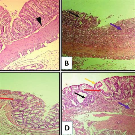 Photomicrographs Of Colon Tissue Sections From Experimental Groups A Download Scientific