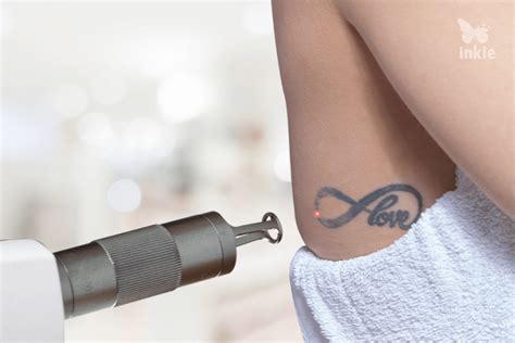 Remover tatuagem a laser mitos e curiosidades sobre a técnica