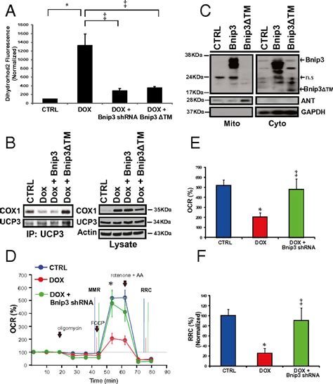 Bnip3 Mediates Doxorubicin Induced Cardiac Myocyte Necrosis And