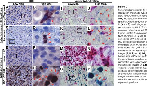 Figure 1 From Infiltrating T Cells Increase IDO1 Expression In