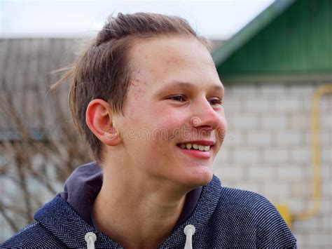Portrait D Un Adolescent Gay Button Dans La Nature Photo Stock Image Du Nature Adolescence