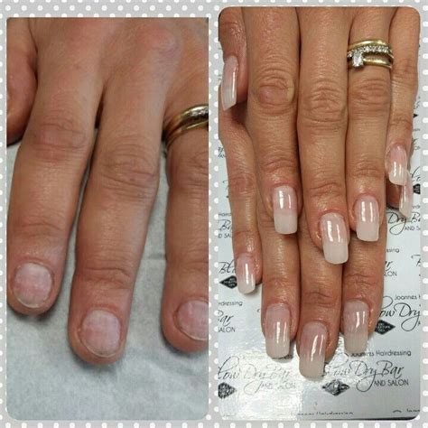 Before And After Biosculpture Tips Added For Length On Bitten Nails And A Natural Overlay Spring