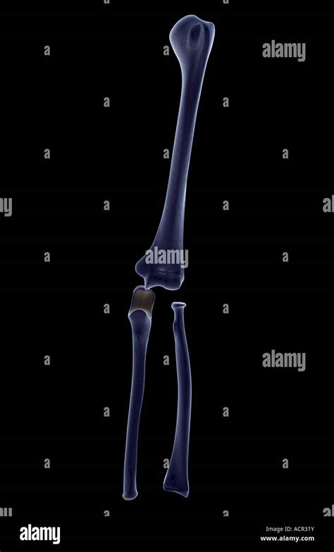 Ossa Arto Superiore Anatomia Immagini E Fotografie Stock Ad Alta