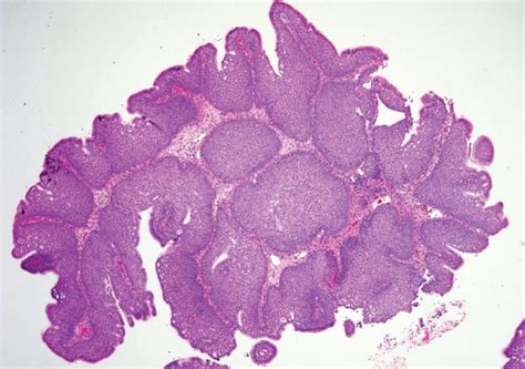 Low Power Magnification Hematoxylin And Eosin Stain Illustrating