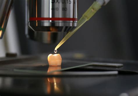 Image of the Day: Enamel Repair | The Scientist Magazine®