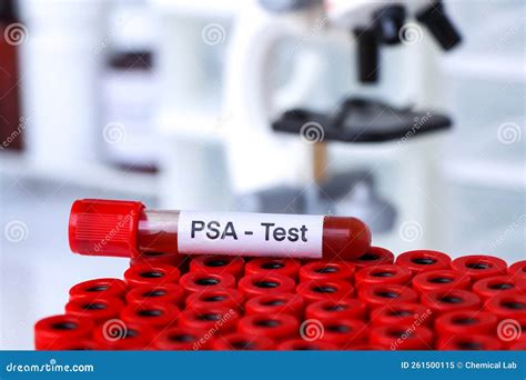 PSA Test To Look For Abnormalities From Blood Stock Image Image Of