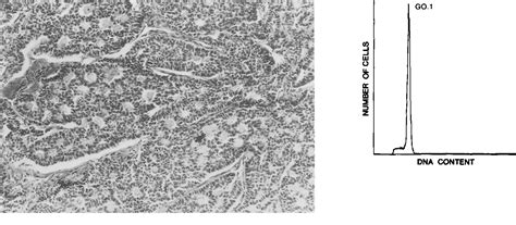 Figure 1 From Flow Cytometric DNA Ploidy Analysis Of Ovarian Granulosa