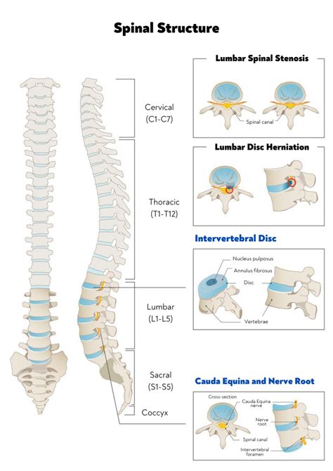 What is spinal canal stenosis? A back pain professional explains symptoms, causes, and remedies ...