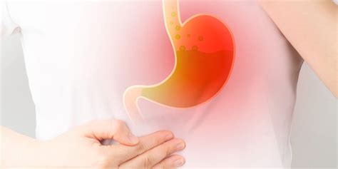 Understanding Acid Reflux: Causes, Symptoms, and Treatment - Dr. Abed Azizi