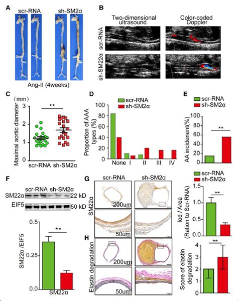 Sm22α Smooth Muscle 22α Deficiency Promotes Aa Formation In Ang Ii