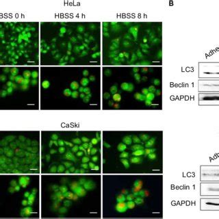 The Level Of Autophagy In Cervical Cancer Tumorspheres And Adherent