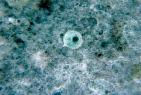 Fileentamoeba Histolytica 01 Wikimedia Commons