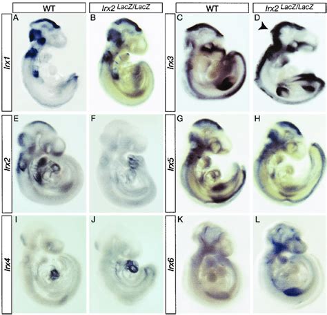 Expression Pattern Of Irx Genes In Irx2 Laczlacz Embryos Whole Mount