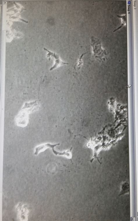 Are these bacteria/yeast contamination? | ResearchGate