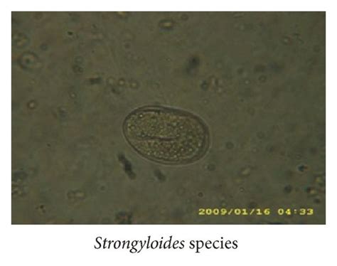 Eggs Of Nematodes As Seen Under The ×40 Objective Of The Microscope On Download Scientific