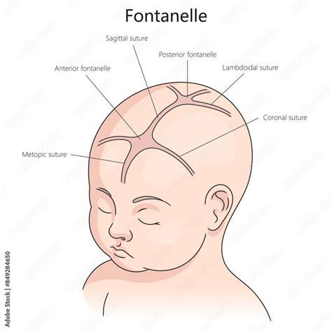 Fontanelle And Sutures In An Infant S Skull Including Anterior And