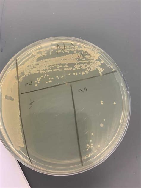 Staphylococcus Saprophyticus Colony Morphology