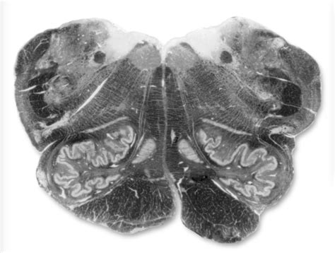 Caudal Open Medulla Sylvius Labeled Diagram Quizlet