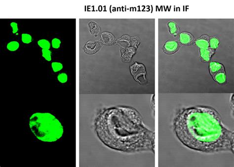 MCMV IE1 Monoclonal Clone IE1 01 EuroMAbNet