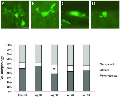 Morphological Changes Of Microglia In The Cultured Mouse Retina After