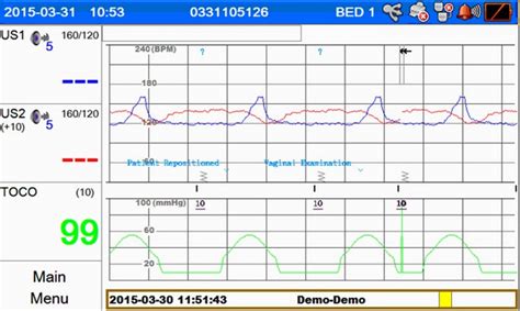 Medical Econet Fetalmonitor Ctg Smart Fc Mit Touchscreen