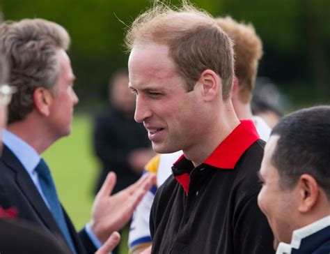 Prince Harry Balding: What We Know So Far | The Bald Gent