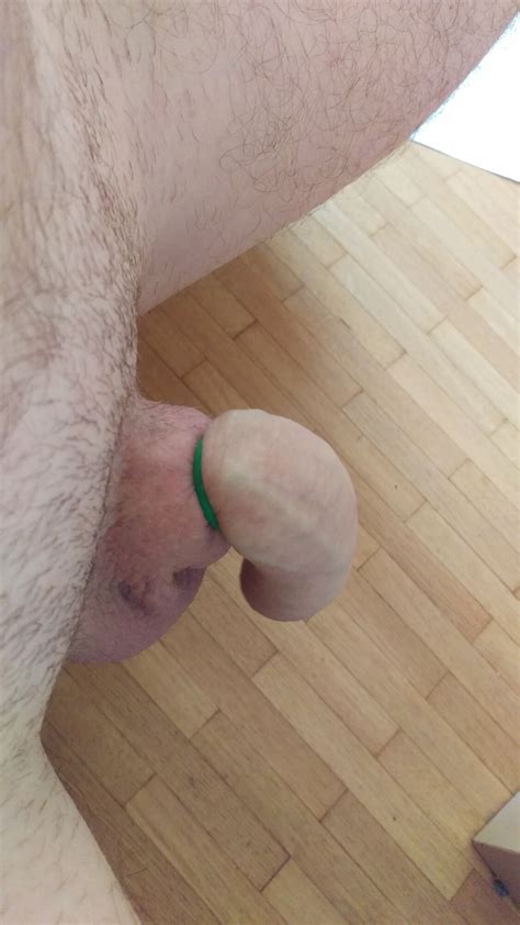 Penis Banding Session 15 Pics Xhamster