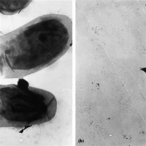 Larvicidal Activity Of Bacillus Thuringiensis Isolates Against