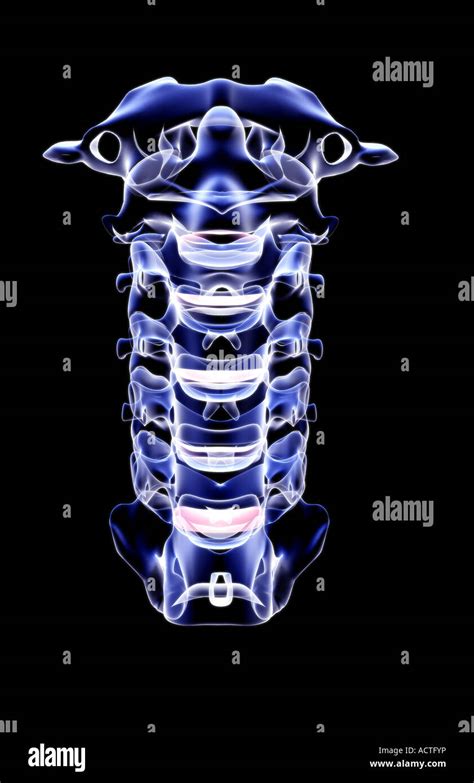 Radiografía del cuello de vértebras cervicales fotografías e imágenes