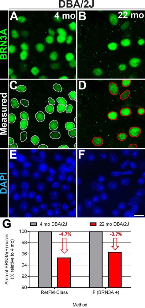 Confirmation That Surviving Retinal Ganglion Cells In Dba J Mice With