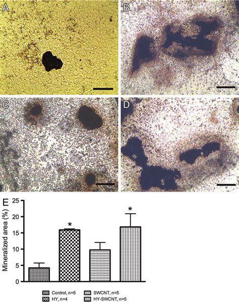 Von Kossa Staining For The Analysis Of Mineralized Bone Nodule