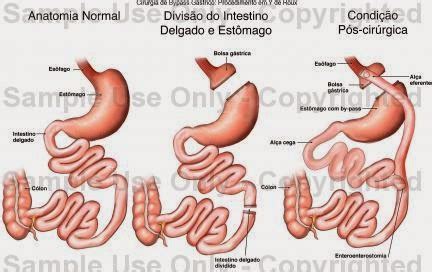 Tr S Tipos De Cirurgia