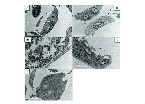 Transmission Electron Micrographs From G Lamblia Trophozoites A Download Scientific