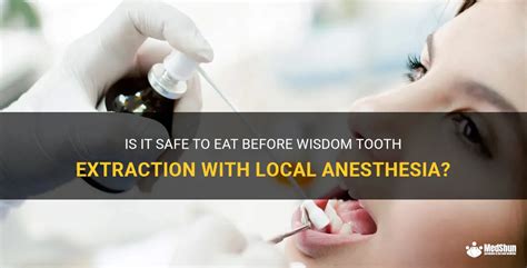 Is It Safe To Eat Before Wisdom Tooth Extraction With Local Anesthesia