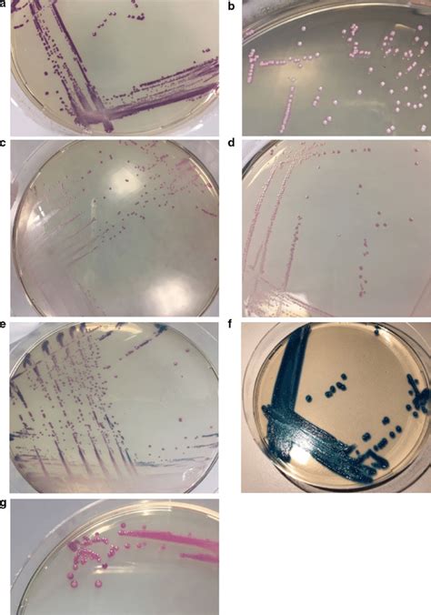 Microbiological Colony Appearance On Chromagar After H