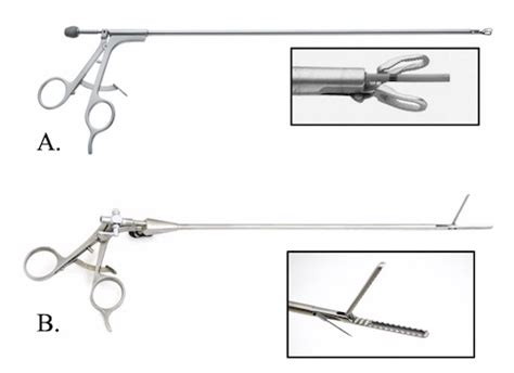 Intraoperative Cholangiogram The Operative Review Of Surgery