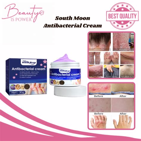 Authentic South Moon Anti Bacterial Eczema Cream Anti Itching Sweat