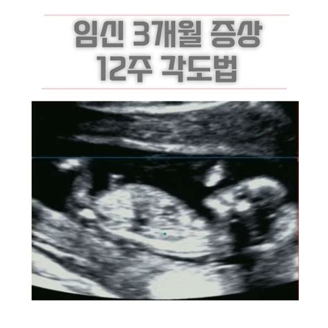 임신 3개월 증상 임신 9주 10주 11주 임신 12주 각도법 및 태아목투명대 완료 네이버 블로그