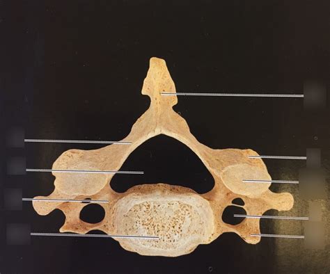 Cervical Vertebra Diagram Quizlet