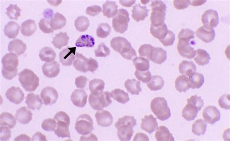 Babesia Cells And Smears