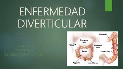 Enfermedad Diverticular Ppt